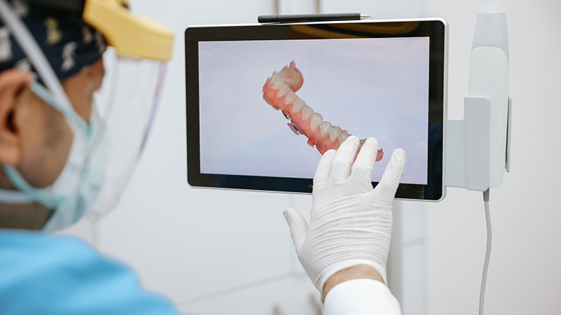 Scanner Intra-oral